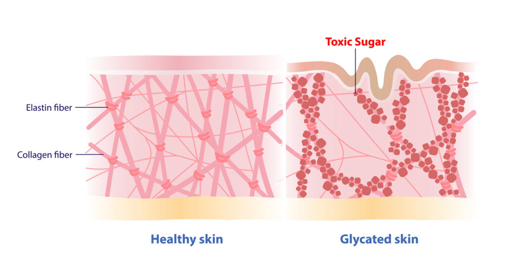 healthy skin vs. glycated skin comparison