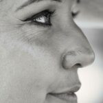 woman with wrinkles around the eye